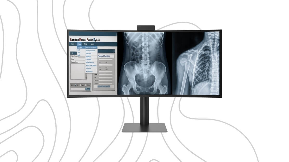 LG impulsa el diagnóstico radiológico con un monitor curvo 5K de 40 pulgadas